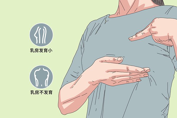 乳腺囊肿预防