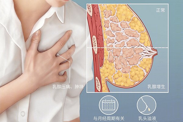 乳腺纤维瘤3级是否需要手术