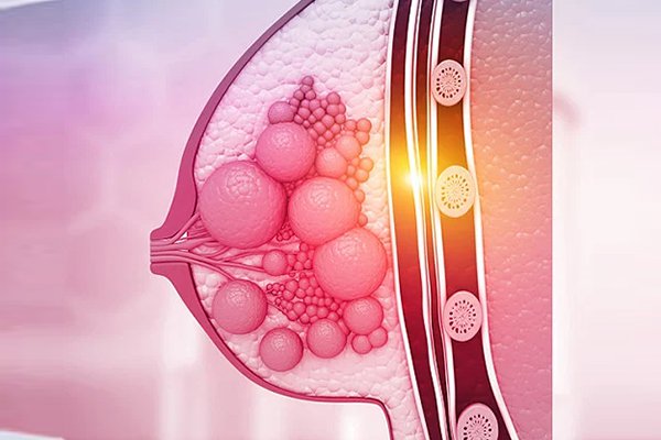 不同原因引起的乳腺增生会有哪些不同类型